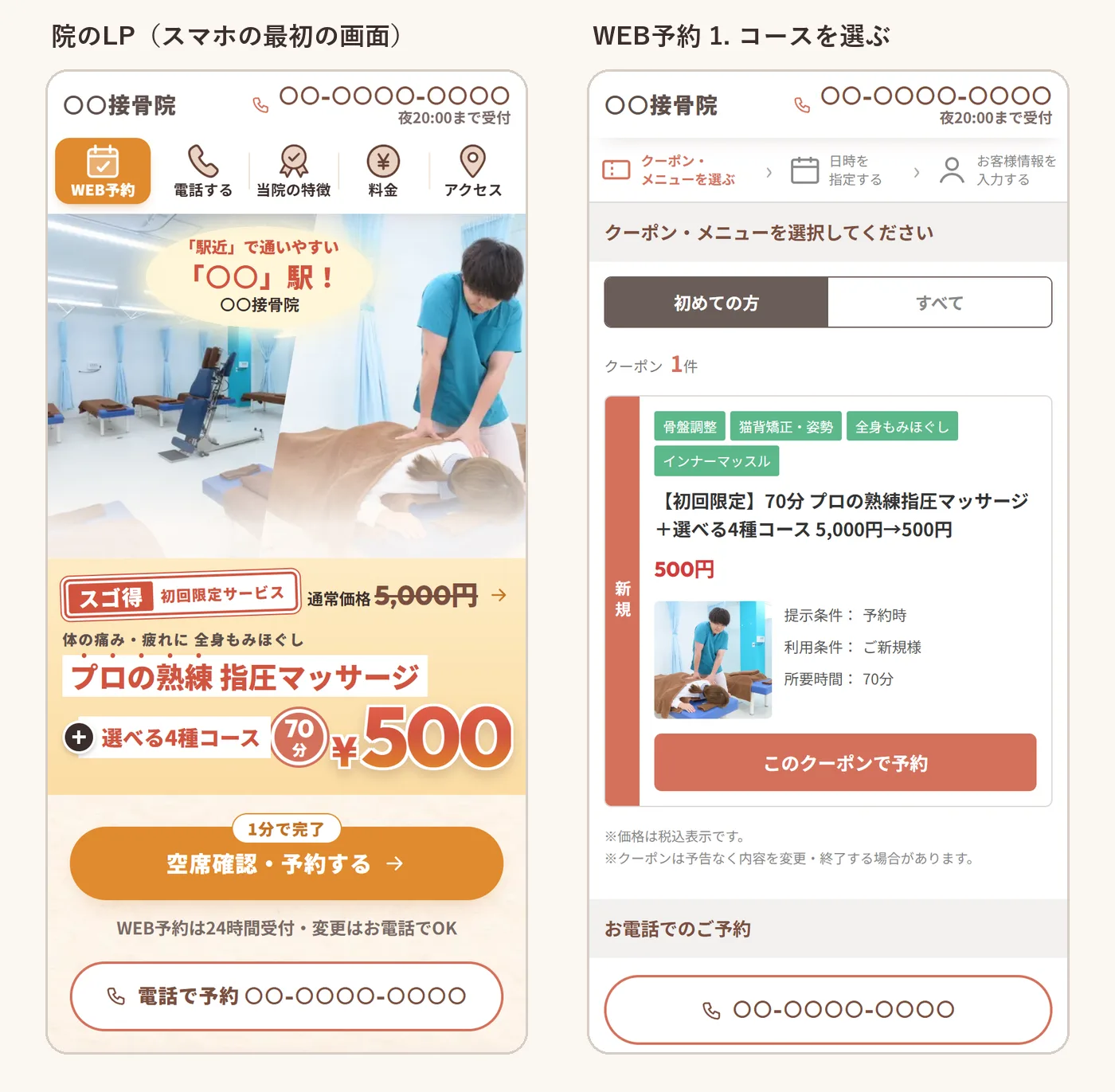 院のLPのスマホの最初の画面と、WEB予約の1つ目の画面。左は値段とコースの時間、右はクーポンを選ぶところ